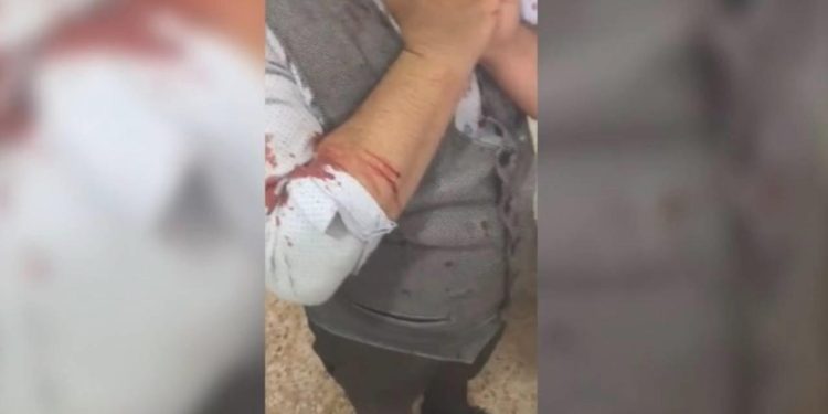 Sandıkta Tekme Tokat ‘Açık Oy’ Hengamesi