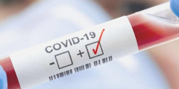 Araştırma: Covid-19 geçiren milyonlarca kişinin koku duyusu geri gelmedi