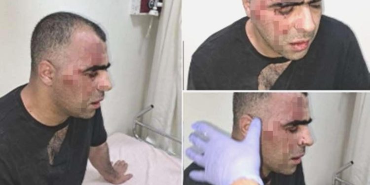 Gazeteci Sinan Aygül: Tatvan Belediye Lideri’nin müdafaalarının saldırısına uğradım