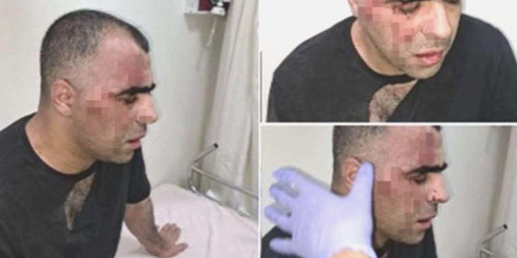 Gazeteci Sinan Aygül’e taarruzda yeni gelişme: Tutuklandılar!