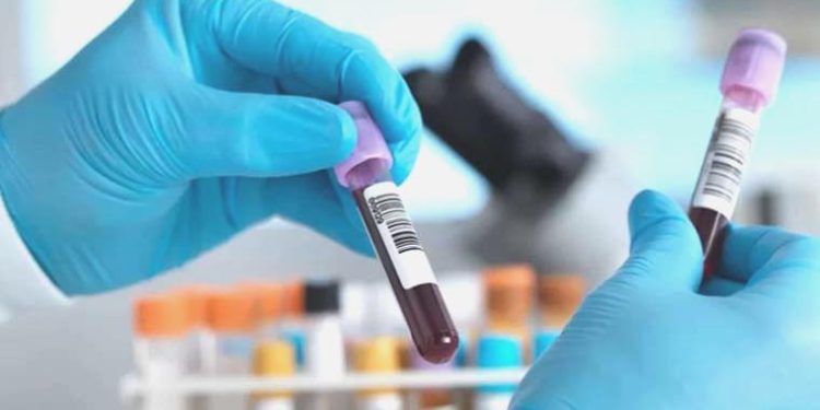 Karın zarı kanserinde erken teşhis hayat kurtarıyor