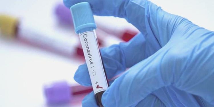 Kovid-19’un laboratuvardan çıkma ihtimalini destekleyen yeni argümanlar