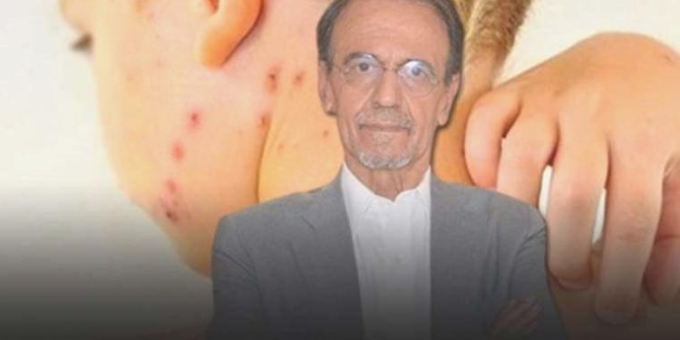Prof. Dr. Mehmet Ceyhan kızamık salgını riskine karşı uyardı: ‘Covid’e benzemez, on bireyden dokuzuna bulaşır’