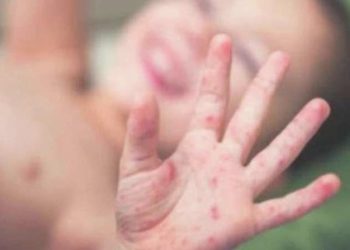 Tabip odasından ‘salgın’ uyarısı: ‘Ölen çocuklar var, en kısa vakitte önlenmeli’