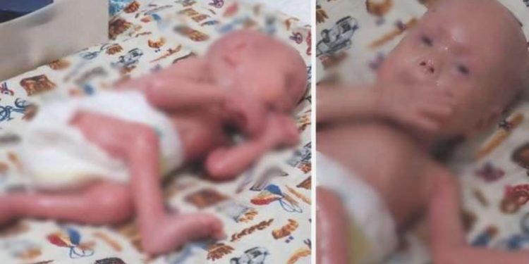 Türkiye günlerce ‘Yılan bebek’ Gökdeniz’i konuşmuştu… Babasının açtığı davada karar çıktı