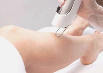 Uzmanından merdiven altı lazer epilasyon uyarısı