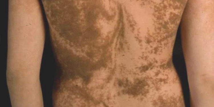 Uzmanlara nazaran insan vücudunda zımnî çizgi ve işaretler var