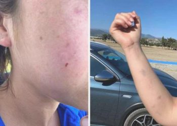 Antalya’da yolda yürüyen bayanlara dehşeti yaşattılar!