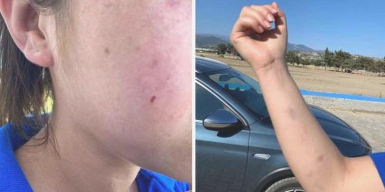 Antalya’da yolda yürüyen bayanlara dehşeti yaşattılar!