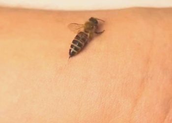 Arı sokması neden bu kadar çok can acıtır?