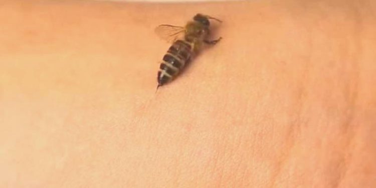 Arı sokması neden bu kadar çok can acıtır?