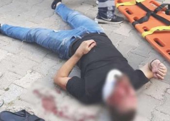 Cam balkon takan emekçi, ikinci kattan düştü