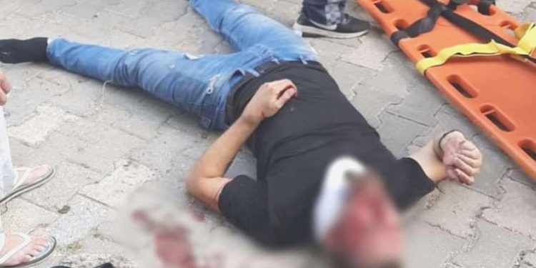 Cam balkon takan emekçi, ikinci kattan düştü