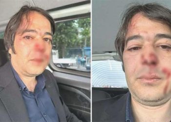 İBB İmar Müdürü Ramazan Gülten’e saldıran sanık hakkında 10 yıl 9 ay mahpus talebi!