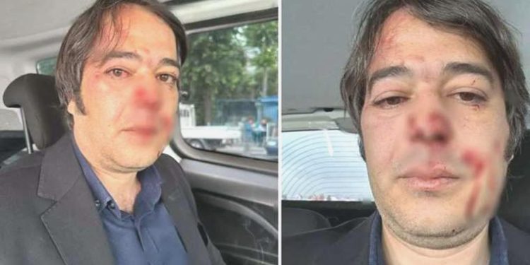 İBB İmar Müdürü Ramazan Gülten’e saldıran sanık hakkında 10 yıl 9 ay mahpus talebi!