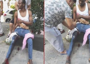 İstanbul’da ‘yanlış zil’ dehşeti: Cüzdanı alınmak istendi, bıçaklandı, silahla vuruldu