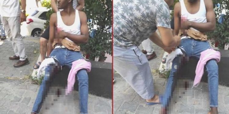 İstanbul’da ‘yanlış zil’ dehşeti: Cüzdanı alınmak istendi, bıçaklandı, silahla vuruldu