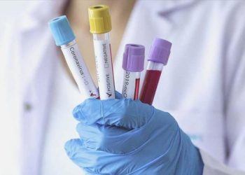 Prof. Dr. Özlü’den bayrama ait Covid açıklaması