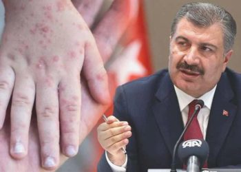 Son dakika… Kızamık olaylarında artış: Bakan Koca İstanbul’a dikkat çekti