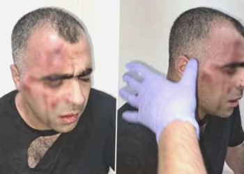 Taarruza uğrayan Sinan Aygül’den ‘barış’ açıklaması: Benim davam devam ediyor