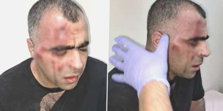 Taarruza uğrayan Sinan Aygül’den ‘barış’ açıklaması: Benim davam devam ediyor