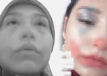 Toplumsal medyada büyük reaksiyon çekmişti! Niğde’de evlendirilmeye çalışılan çocuğun anne ve babasına gözaltı