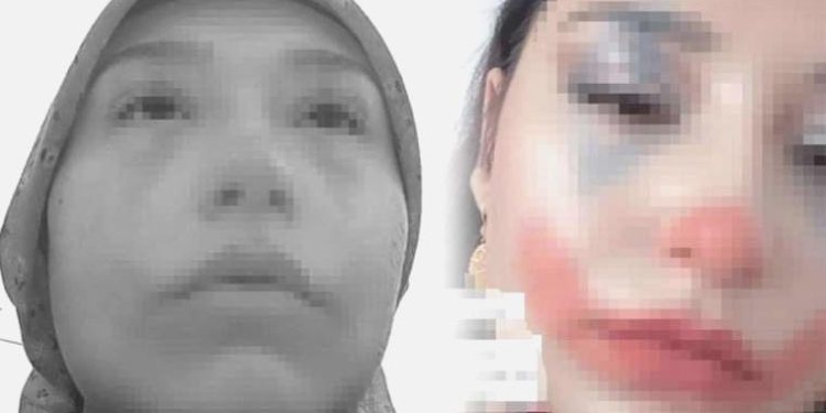 Toplumsal medyada büyük reaksiyon çekmişti! Niğde’de evlendirilmeye çalışılan çocuğun anne ve babasına gözaltı