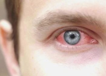 Uzmanından ihtar: Tatil öncesi göz sıhhatinizi ertelemeyin