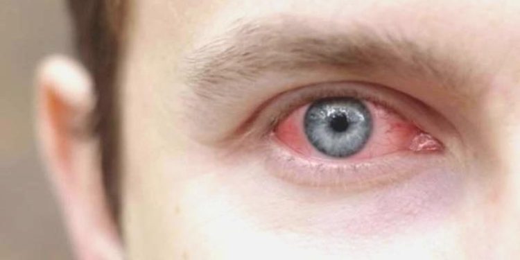 Uzmanından ihtar: Tatil öncesi göz sıhhatinizi ertelemeyin