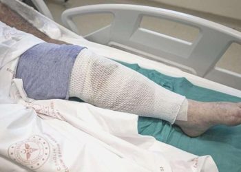 Ağrısı geçsin diye uyguladığı metot hastanelik etti!