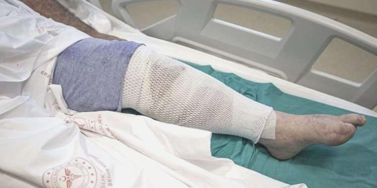 Ağrısı geçsin diye uyguladığı metot hastanelik etti!