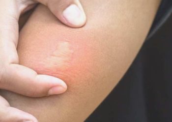 Arkadaşına yardım etmek istedi, arı sokması sonucu hayatını kaybetti