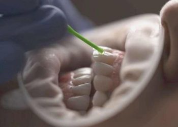 Dökülen dişlerin tekrar çıkmasını sağlayan bir tedavi geliyor