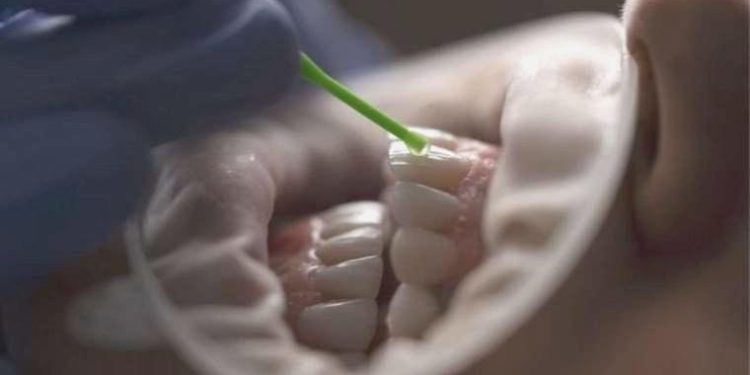 Dökülen dişlerin tekrar çıkmasını sağlayan bir tedavi geliyor