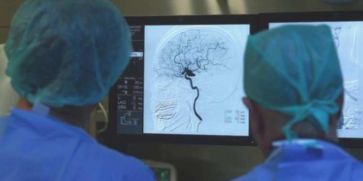 Felç tedavisinde umut veren yeni çalışma