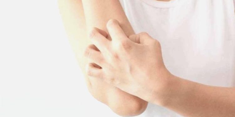 Gerilime bağlı cilt hastalıkları arttı