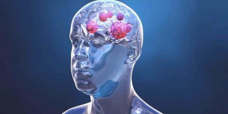 Harvard Üniversitesi: Yapay zeka beyin tümörü tedavisine yardımcı olabilir