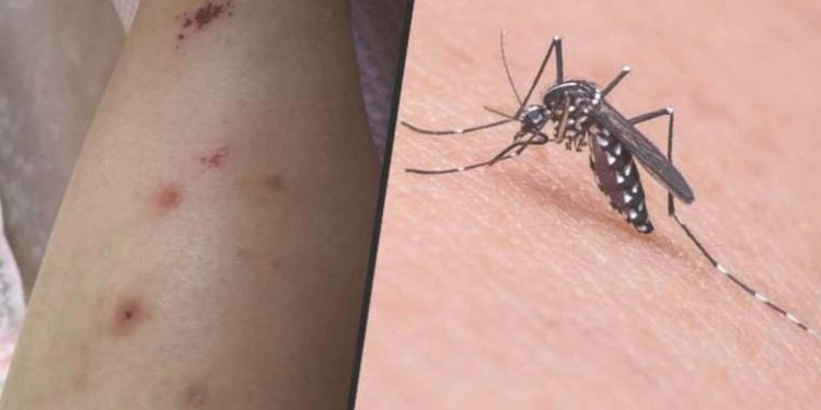 İzmir’de Asya Kaplan Sivrisineği paniği