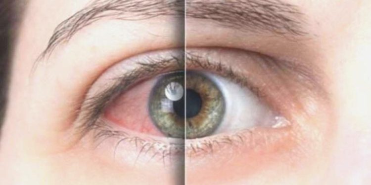 Klima gözlerinizi kurutuyorsa bunlara dikkat edin! Göz sıhhatinizi korumak işte bu kadar kolay