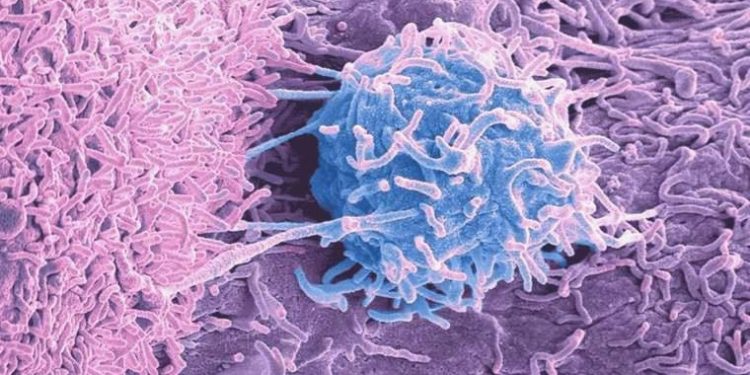 Tümörlerde yaşayan mikroplar, kanserin nedeni ve tedavisiyle ilgili ne çeşit ipuçları veriyor?