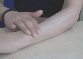 Uzmanı uyardı: Güneş yanıklarına konutta tedavi uygulanmamalı