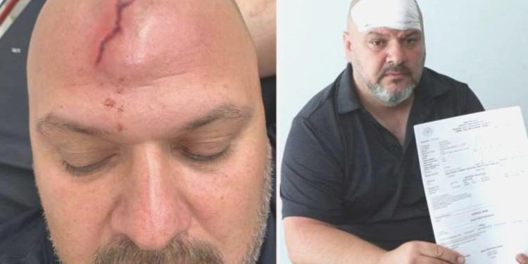 100 bin lira kira talebini reddeden kiracıya ‘beyzbol sopalı saldırı’ argümanı