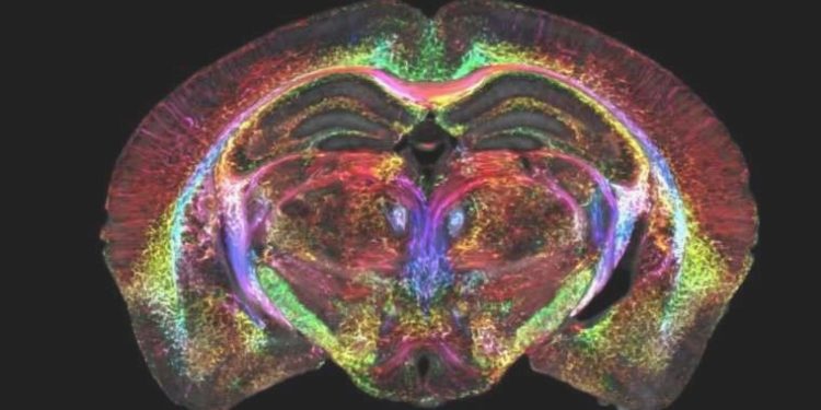 Bu teknoloji beyin görüntülemede ihtilal yaratacak! Alzheimer, Parkinson ve İnme üzere hastalıklarda erken teşhis imkanı