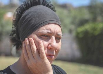 Diş ağrısı sandığı ‘delirten hastalık’ hayatını mahvetti: ‘Yüzümün sağ tarafını koparıp atmak istiyorum’