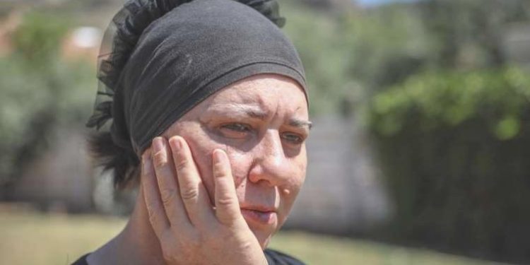 Diş ağrısı sandığı ‘delirten hastalık’ hayatını mahvetti: ‘Yüzümün sağ tarafını koparıp atmak istiyorum’