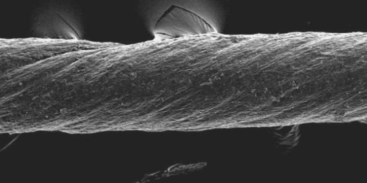 Kendinden ilaçlı dikişler