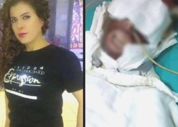 Konutuna gizlice girip kimyasal unsur ile yaktı: Bayanın bedeninin yüzde 20’si yandı, mahzur oranı yüzde 95!