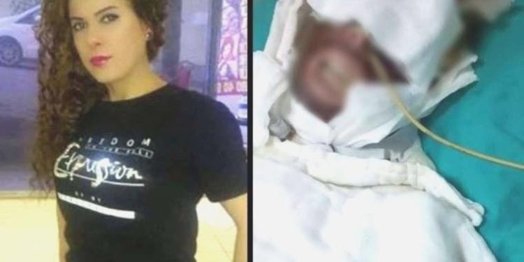 Konutuna gizlice girip kimyasal unsur ile yaktı: Bayanın bedeninin yüzde 20’si yandı, mahzur oranı yüzde 95!