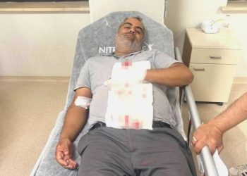 Bahçede otururken ‘yorgun mermi’ isabet etti