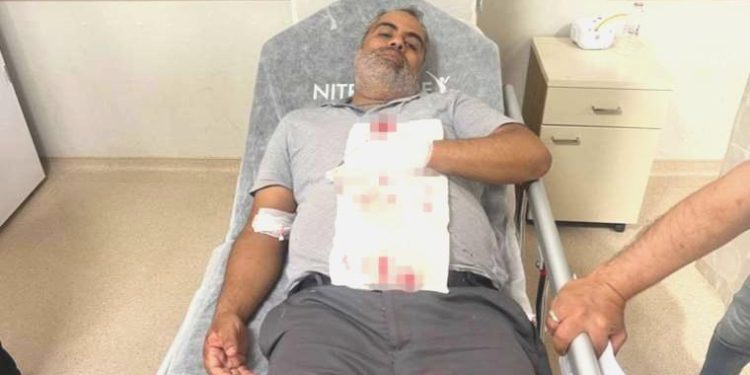 Bahçede otururken ‘yorgun mermi’ isabet etti